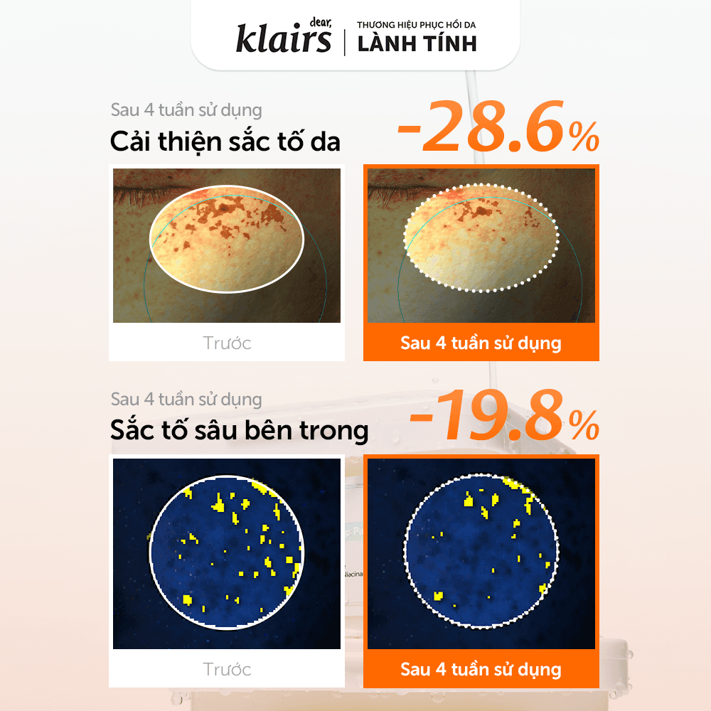 Dear, Klairs Mặt nạ giấy Freshly Vitamin Skin Prep Pads 290ml thumb 8