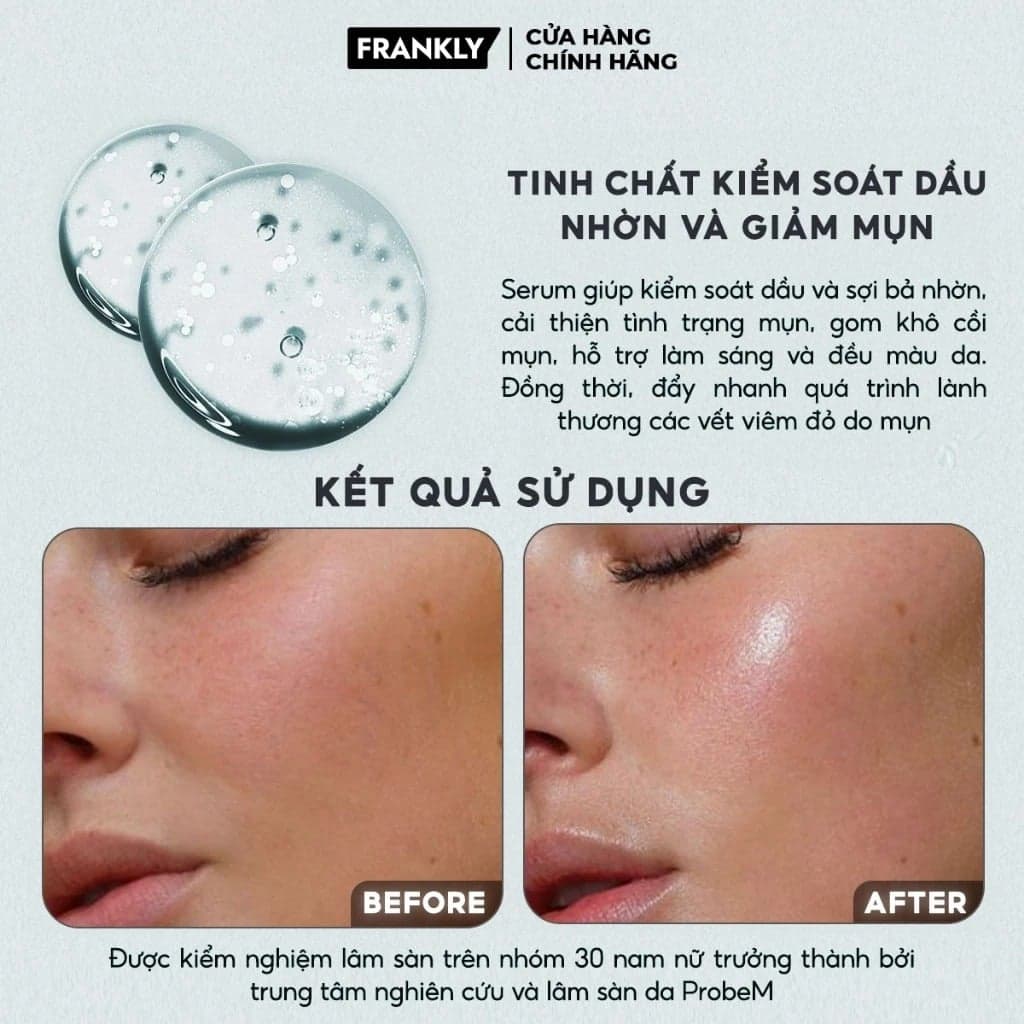 Frankly Serum kiểm soát dầu nhờn giảm mụn Niacinamide 15% Zinc Beads Serum 30ml thumb 3