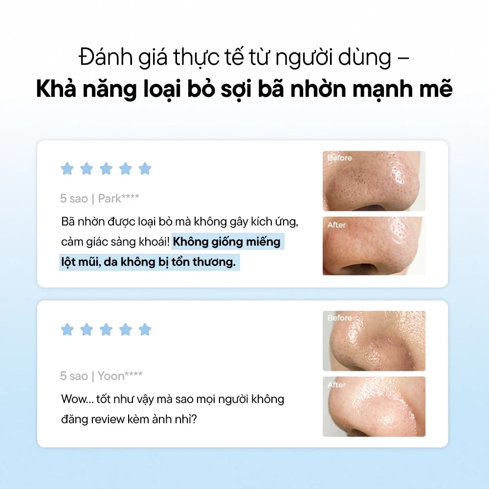 One-Day'syou Tinh chất giảm mụn p.z ssoc ssoc No More Blackhead 100ml 4