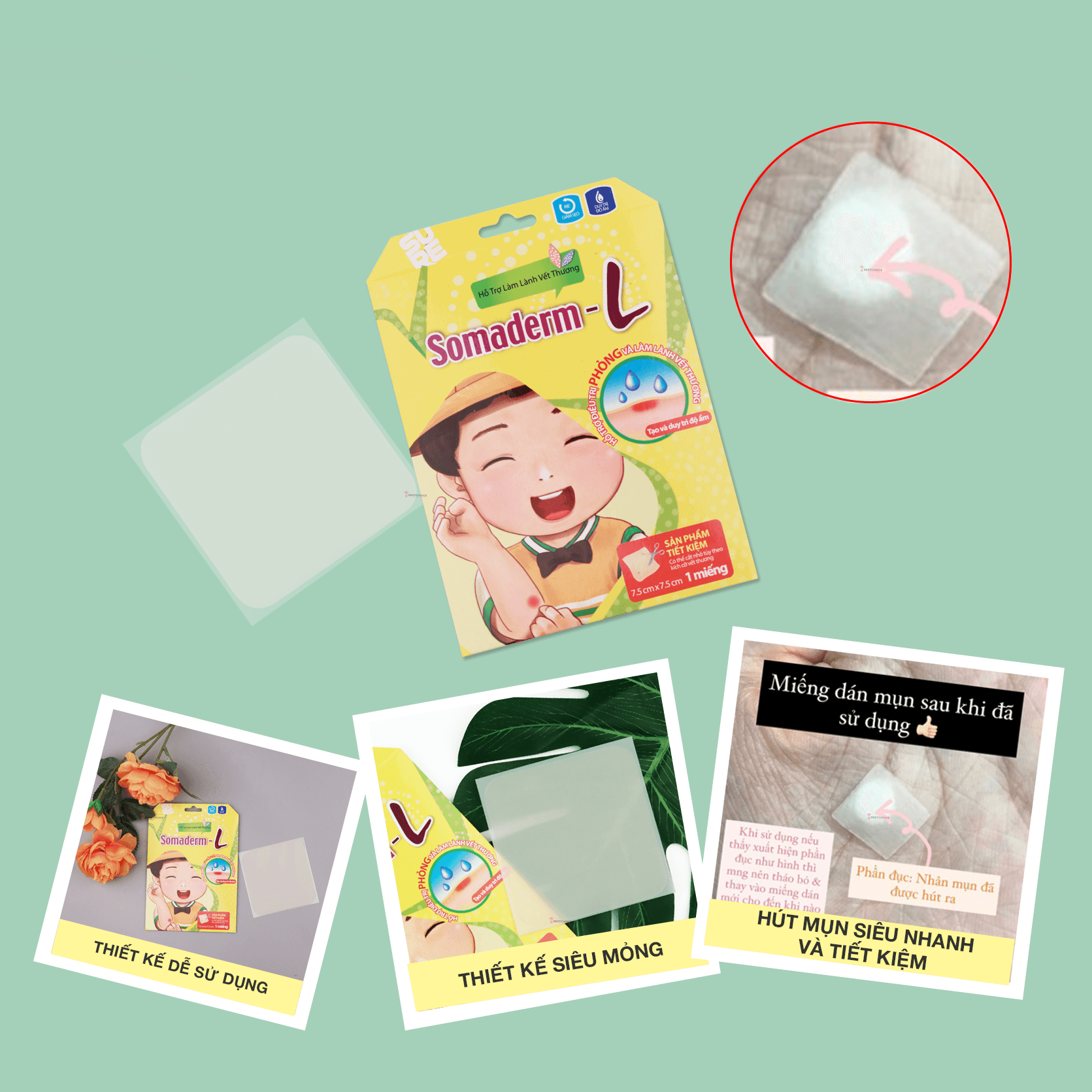 Somaderm Miếng dán hỗ trợ làm lành vết thương 1 miếng 7.5cm *7.5cm 3