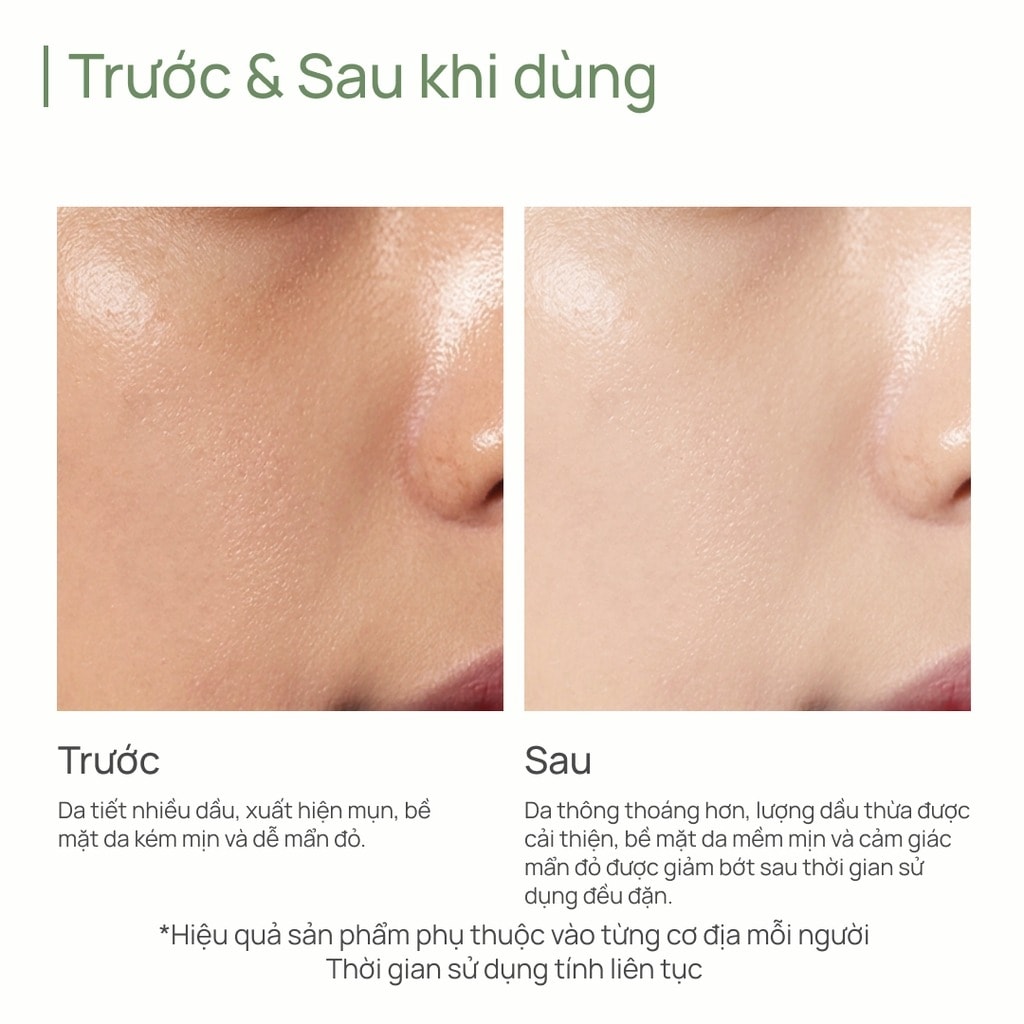 CHANDO Tinh chất Salicylic Acid Oil-control & Anti-acne Essence 40ml 4