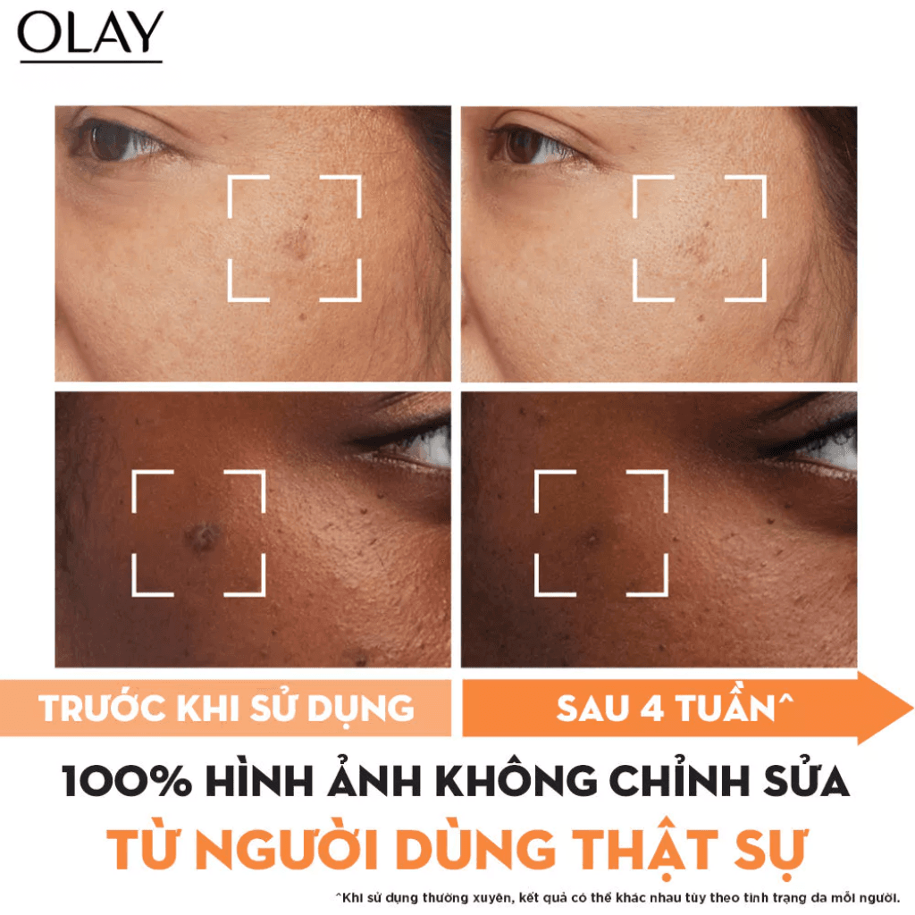 Olay Kem dưỡng ẩm trắng da Niacinamide & Vitamin C 50g thumb 6