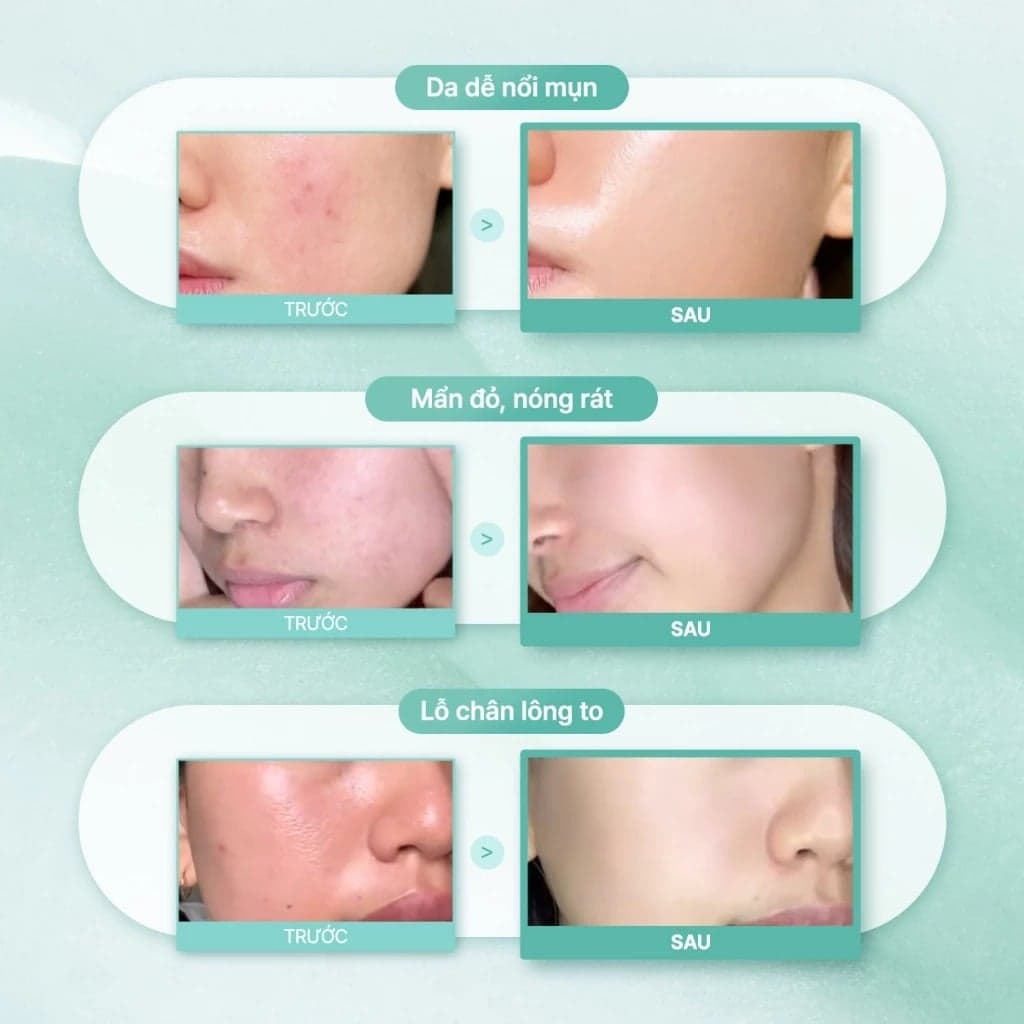Some By Mi Tinh chất PDRN Spirulina Soothing Repair Serum 50ml thumb 7