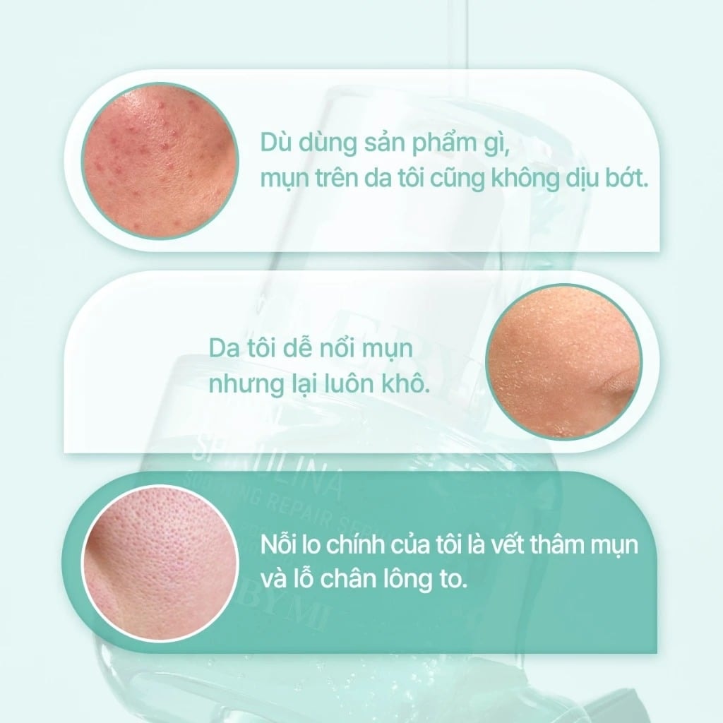 Some By Mi Tinh chất PDRN Spirulina Soothing Repair Serum 50ml 5