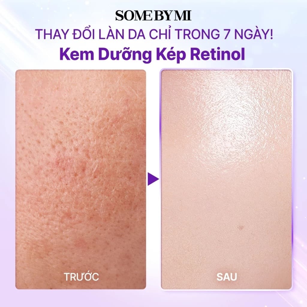 Some By Mi Kem dưỡng Retinol Bakuchiol Dual Cream 50ml thumb 7