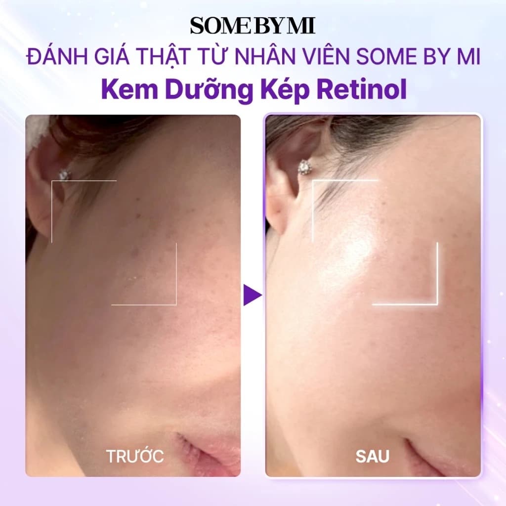 Some By Mi Kem dưỡng Retinol Bakuchiol Dual Cream 50ml thumb 8