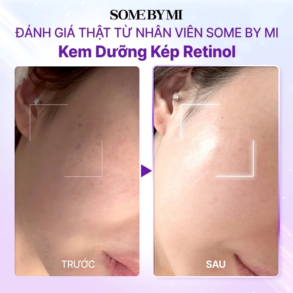 Some By Mi Kem dưỡng Retinol Bakuchiol Dual Cream 50ml 8