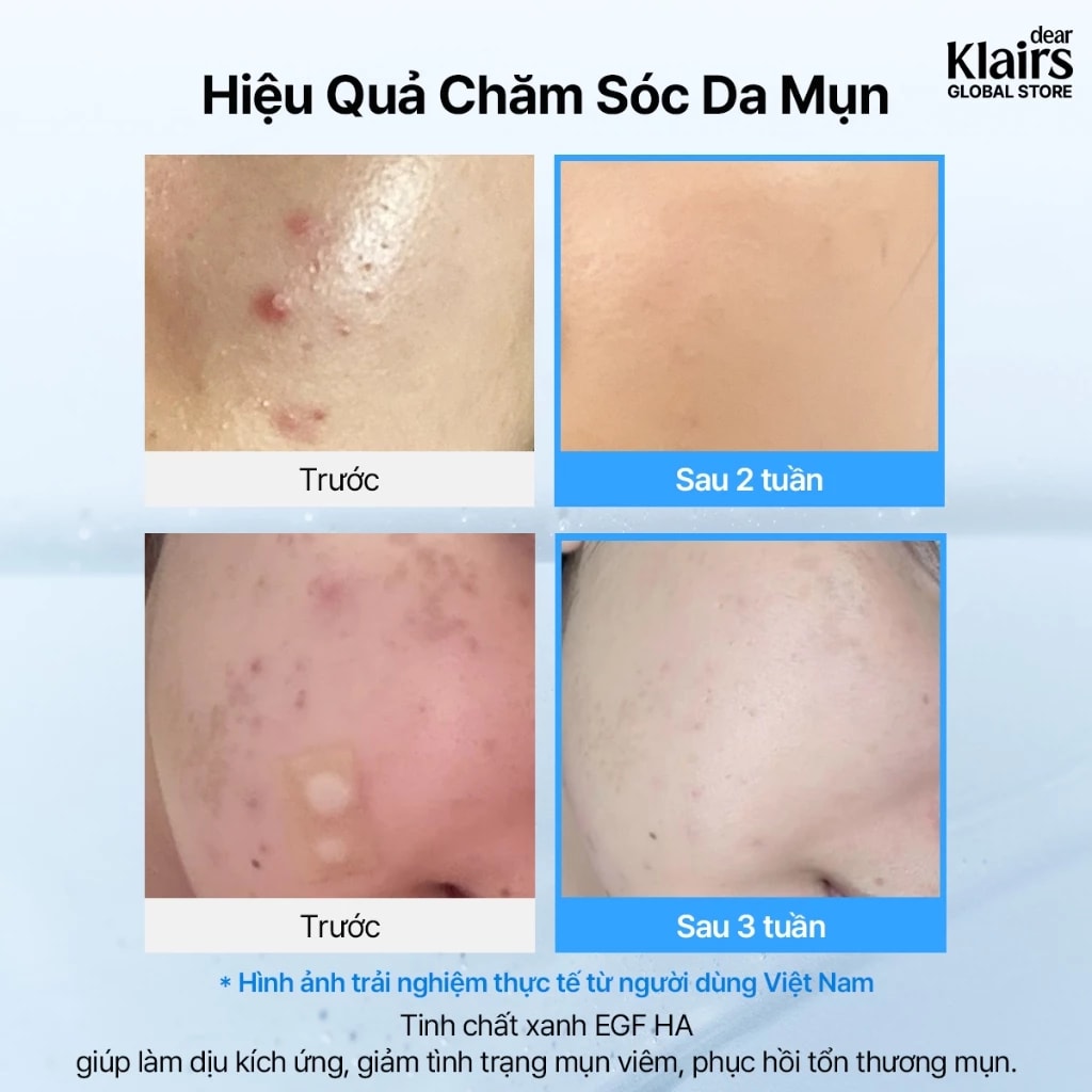 dear Klairs Miếng cotton thấm nước hoa hồng EGF Blue Calming Toner Pad 150ml 4
