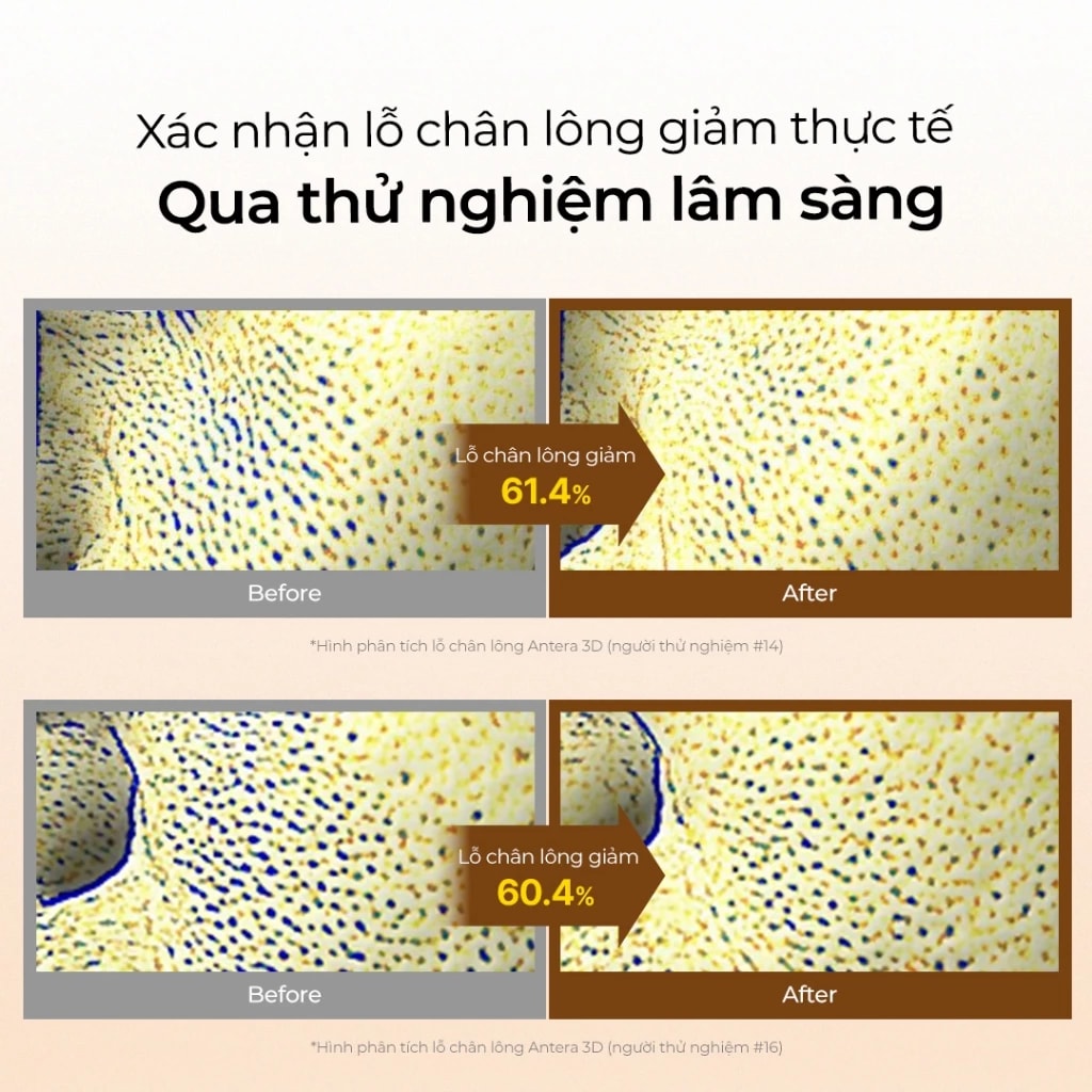 One-Day'syou Nước hoa hồng Help Me Pore-T Pad 10